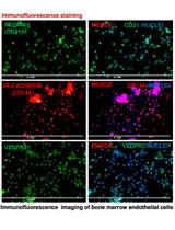 Isolation of CD31+ Bone Marrow Endothelial Cells (BMECs) from Mice