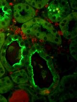 小鼠肾脏中的 CD45 免疫组织化学