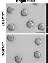 Gamete Fusion Assay in Mice