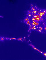 In vitro Fluid Shear Stress Induced Sclerostin Degradation and CaMKII Activation in Osteocytes