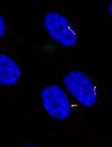Quantitative Determination of Primary Cilia Protein Distribution Using Immunofluorescence Staining and MATLAB Analysis