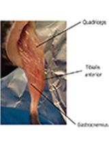 一种分离和体外扩增高纯度小鼠和人类卫星细胞的简单方法