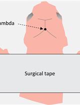 Delivery of AAV for Expression of Fluorescent Biosensors in Juvenile Mouse Hippocampus