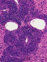 Reconstruction of Human AML Using Functionally and Immunophenotypically Defined Human Haematopoietic Stem and Progenitor Cells as Targeted Populations