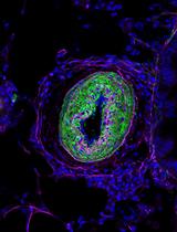 Chronic Daily House Dust Mite Exposure in Mice is an Effective Model to Quantify the Effect of Pharmacologic Agents on Discrete Stages of Artery Remodeling in Pulmonary Hypertension