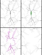Subcellular RNA-seq for the Analysis of the Dendritic and Somatic Transcriptomes of Single Neurons