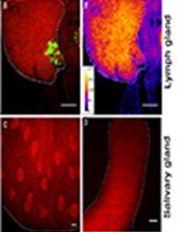 Combination of Immunofluorescence and Quantitative Fluorescence In-situ Hybridization for Analysing Differential Gene Expression in the Niche Cells of the Drosophila Lymph Gland 