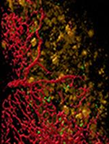 An Alternative Technique for Monitoring the Live Interaction of Monocytes and Tumor Cells with Nanoparticles in the Mouse Lung 