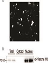 Fractionation and Extraction of Crude Nuclear Proteins From Arabidopsis Seedlings 