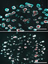 Preparation and Cultivation of Colonic and Small Intestinal Murine Organoids Including Analysis of Gene Expression and Organoid Viability