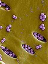 Rapid <em>in vitro</em> and <em>in vivo</em> Evaluation of Antimicrobial Formulations Using Bioluminescent Pathogenic Bacteria 
