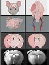Transient Middle Cerebral Artery Occlusion with an Intraluminal Suture Enables Reproducible Induction of Ischemic Stroke in Mice