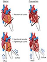 小鼠肺边缘单核细胞体外微囊泡摄取