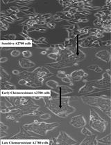 Developing Clinically Relevant Acquired Chemoresistance Models in Epithelial Ovarian Cancer Cell Lines