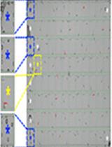 Large-scale Analysis of Sleep in Zebrafish