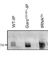 Immunoprecipation Assay to Quantify the Amount of tRNAs associated with Their Interacting Proteins in Tissue and Cell Culture