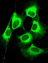 NBD-lipid Uptake Assay for Mammalian Cell Lines