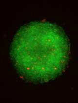 Optimization of Extracellular Flux Assay to Measure Respiration of Anchorage-independent Tumor Cell Spheroids