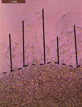 Spherical Invasion Assay: A Novel Method to Measure Invasion of Cancer Cells