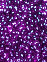 An in vitro Blood-brain Barrier Model to Study the Penetration of Nanoparticles