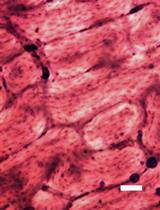 A Rapid Protocol for Direct Isolation of Osteoclast Lineage Cells from Mouse Bone Marrow