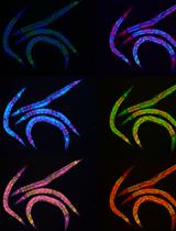 Rapid Lipid Quantification in <em>Caenorhabditis elegans</em> by Oil Red O and Nile Red Staining