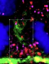 Colocalization Analysis for Cryosectioned and Immunostained Tissue Samples with or without Label Retention Expansion Microscopy (LR-ExM) by JACoP