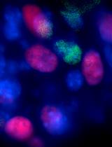 Skeletal Stem Cell Isolation from Cranial Suture Mesenchyme and Maintenance of Stemness in Culture