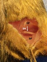 A Novel Standardized Peripheral Nerve Transection Method and a Novel Digital Pressure Sensor Device Construction for Peripheral Nerve Crush Injury