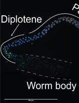 TUNEL Labeling to Detect Double-stranded DNA Breaks in <em>Caenorhabditis elegans</em> Gonads