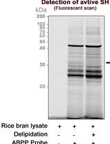 Activity-based Protein Profiling of Serine Hydrolase Superfamily Enzymes