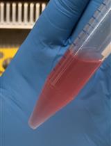 Generation, Maintenance and HBV Infection of Human Liver Organoids