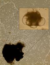 Differentiation of Human Induced Pluripotent Stem Cell into Macrophages