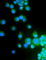 Preparation, Characterization, and Cell Uptake of PLGA/PLA-PEG-FA Nanoparticles