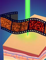 Quantitative and Anatomical Imaging of Human Skin by Noninvasive Photoacoustic Dermoscopy