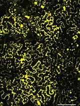 <em>In vitro</em> Auto- and Substrate-Ubiquitination Assays