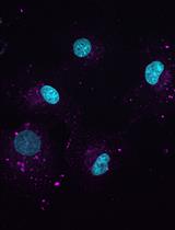Image-based Quantification of Macropinocytosis Using Dextran Uptake into Cultured Cells