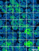 In vivo Ca2+ Imaging in Mouse Salivary Glands