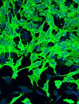 Isolation and Culture of Cranial Neural Crest Cells from the First Branchial Arch of Mice