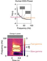 Stimulus-induced Robust Narrow-band Gamma Oscillations in Human EEG Using Cartesian Gratings