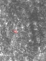 Isolation of tdTomato Expressing Inter-follicular Epidermal Melanocytes or Keratinocytes from Mouse Tail Skin