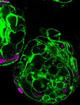 Production of Recombinant Hepatitis B virus (HBV) and Detection of HBV in Infected Human Liver Organoids