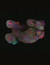 Low-viscosity Matrix Suspension Culture for Human Colorectal Epithelial Organoids and Tumoroids