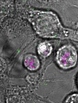 Single Molecule Tracking Nanoscopy Extended to Two Colors with MTT2col for the Analysis of Cell-Cell Interactions in Leukemia