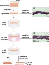 <em>Ex vivo</em> Human Skin Infection with Herpes Simplex Virus 1