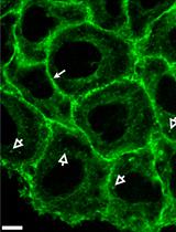 mNeonGreen对 HeLa 细胞进行 CRISPR/Cas9 基因编辑以标记蛋白质