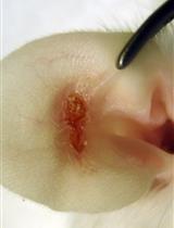 Protocol to Induce Follicular T Helper Cells, Germinal Centers, and Skin Lesions in Mouse Models for Skin Blistering Diseases