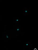 A Highly Sensitive Method to Efficiently Profile the Histone Modifications of FFPE Samples