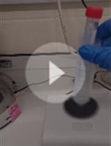 Identification and Monitoring of Nucleotide Repeat Expansions Using Southern Blotting in Drosophila Models of C9orf72 Motor Neuron Disease and Frontotemporal Dementia