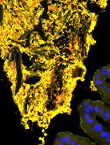 Purification of the Bacterial Amyloid “Curli” from Salmonella enterica Serovar Typhimurium and Detection of Curli from Infected Host Tissues